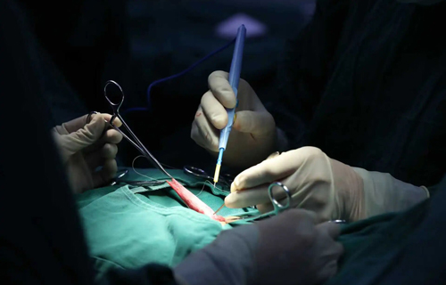 男娃尿线歪斜、总尿湿裤子？这可能是尿道下裂在“报警”